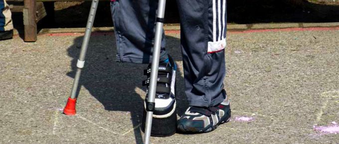 Best Shoes for Broken Foot Recovery Buying Guide